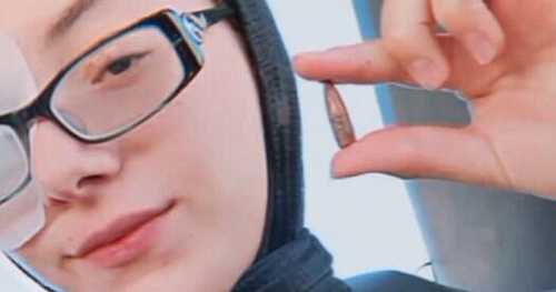 Doctors remove bullet from Palestinian woman's head after 4 months of agony